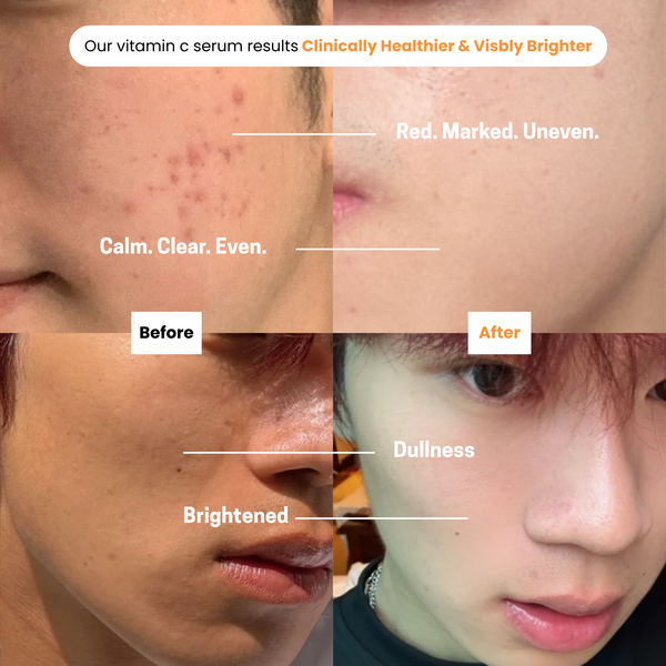 Vitamin C Serum 20% - With Vitamin E & Ferulic Acid